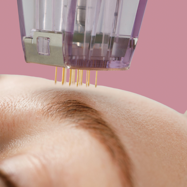 Micro Needling